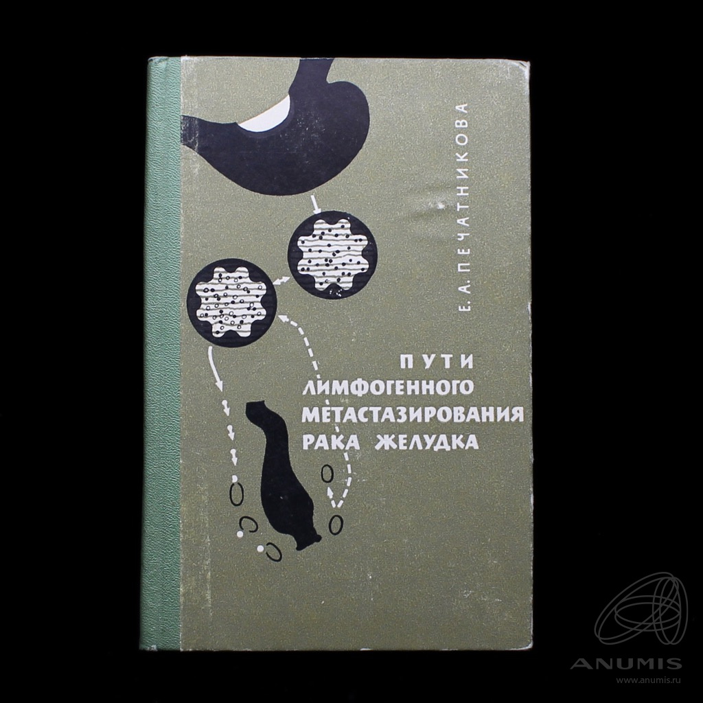 Книга «Пути лимфогенного метастазирование рака желудка». Издательство  «Медицина», г. Москва. Автор: Е.А. Печатникова. 104 стр. Тираж 7000 эк…